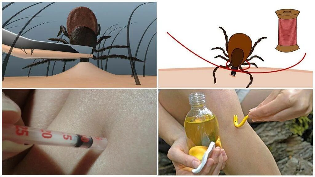 Как вылечить клещ в домашними. Как вытащить клеща у человека. ккаккк выдавитььь кклещща.