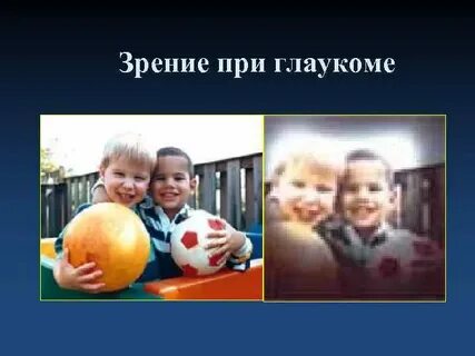 Зрение при глаукоме