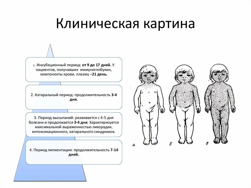 Корь краснуха дифтерия коклюш. Характеристика высыпаний при кори. Этапность сыпи корь краснуха. Локализация сыпи при кори.