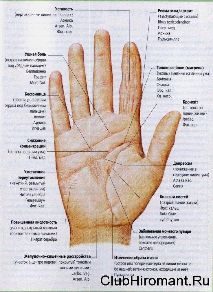 Определить заболевание по рукам. Обозначение линий на руке хиромантия. Правая рука линии хиромантия. Гадание по ладони руки что означают линии на руке. Линия жизни на руке.