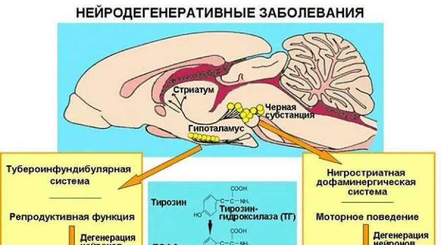 Болезнь заболевание мозга. Нейродегенеративные заболевания. Нейродегенеративныетзабрлевания. Нейродегенеративные заболевания нервной системы. Нейродеегенеративные забол.