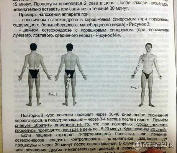 Алмаг колено как правильно. Алмаг-01 сустав. Инструкция к аппарату алмаг. Схема прибора алмаг+. Инструкция алмаг 1 с картинками.