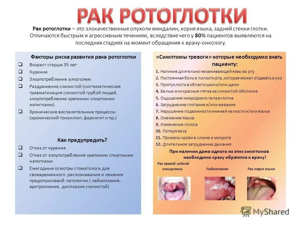 Когда держишь пост можно ли глотать слюну. Начальная стадия опухоли горла. Злокачественные новообразования гортани.