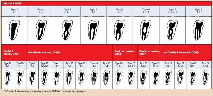 Классификация корневых каналов Vertucci. Корневые каналы зубов топография таблица. Типы конфигурации корневых каналов по Вертуччи. Схема устьев корневых каналов зубов.
