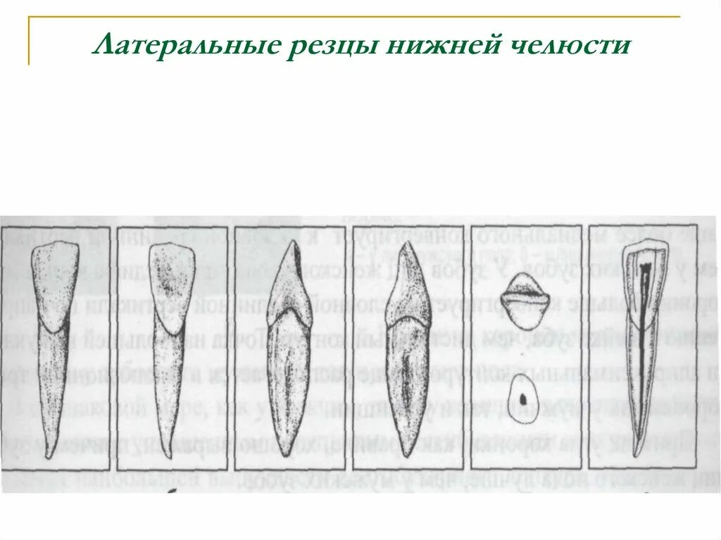 Центральный медиальный резец верхней челюсти. Нижний боковой резец. Латеральный резец верхней челюсти. Верхний боковой резец верхней челюсти. Нижний боковой резец.