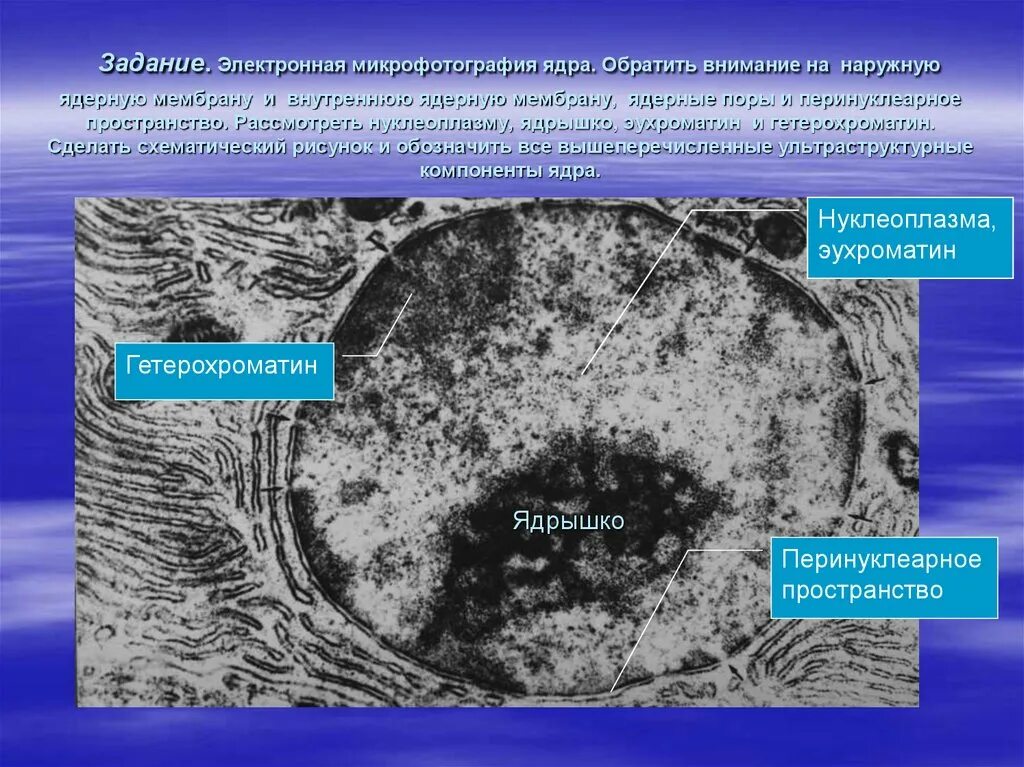Какую функцию выполняет структура представленная на микрофотографии