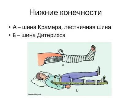 Лестничная шина
