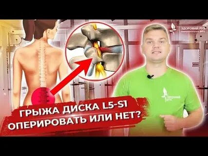 Обострение поясничных грыж