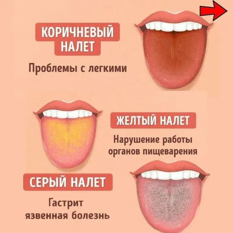 Найти язык по тексту. Здоровье по цвету языка. распознавание болезни по языку.