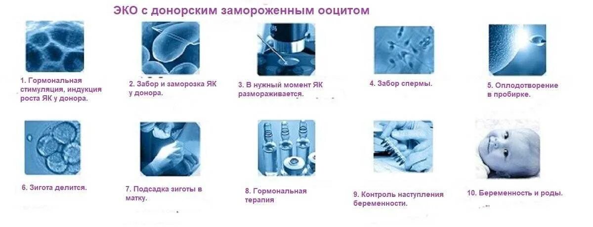 Этапы протокола эко. Этапы экстракорпоральное оплодотворение. Этапы экстракорпорального оплодотворения. Этапы при эко. Этапы эко по дням