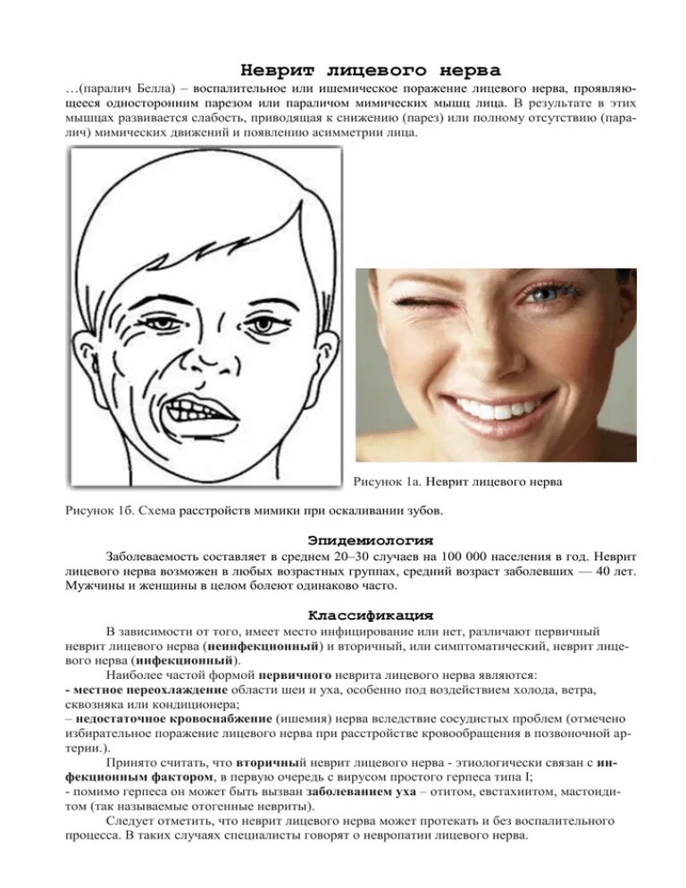 Схема массажа неврита лицевого нерва. Методика массажа при неврите лицевого нерва. Техника самомассажа при неврите лицевого нерва. Самомассаж лица при неврите лицевого нерва схема.