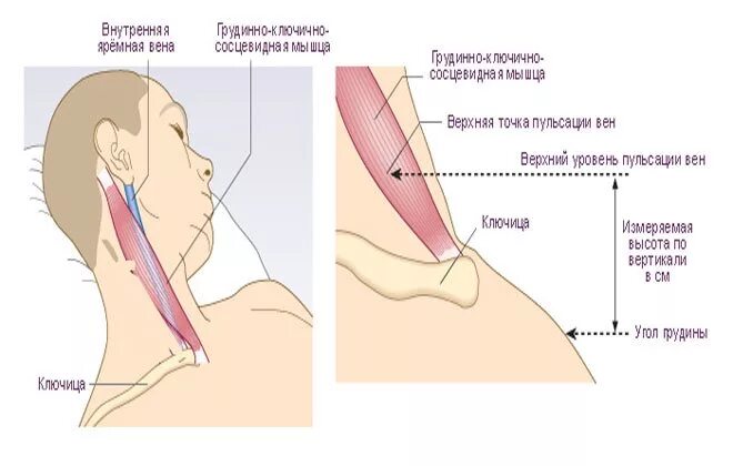 Почему пульсирует шея