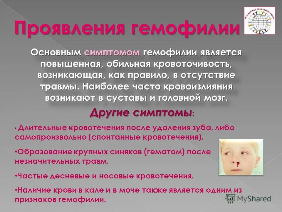 Дети больные гемофилией