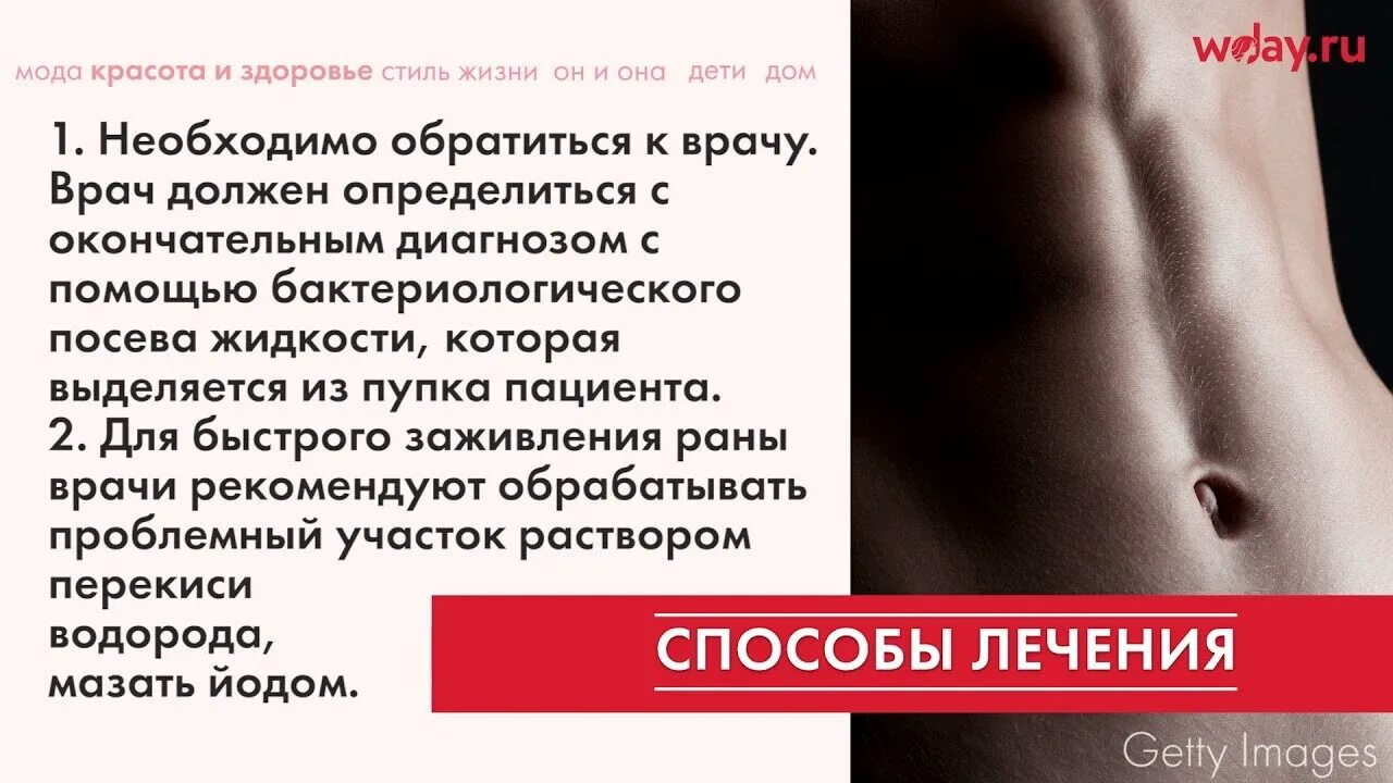 Почему из пупка запахло. Воспаление пупка у женщин. Жидкость из пупка у женщин. Почему из пупка запахло. Почему из пупка запахло.