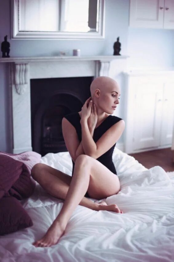 Лысая марина вовченко. Лысая девочка ногу. Лысая девочка ногу. Лысая девочка ногу. Лысая девочка.