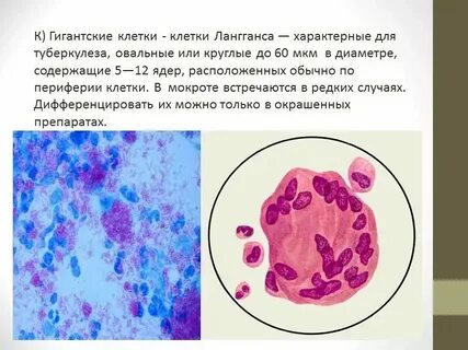 Атипичные