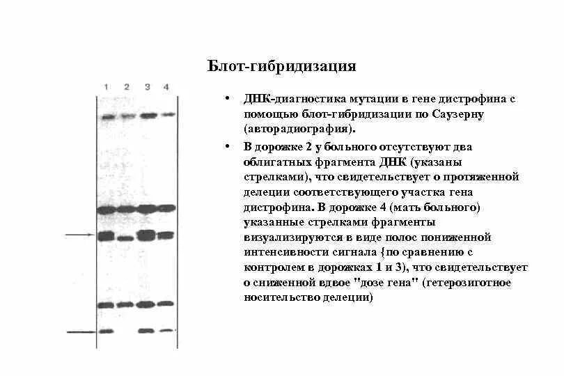 Суть метода гибридизации. Дозовый Блот-гибридизационный анализ. Блот гибридизация суть метода. Гибридизация ДНК Саузерн Блот. Блот гибридизация по Саузерну.