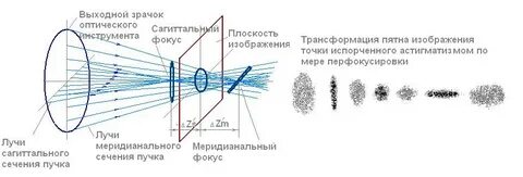 Астигматизм аберрация