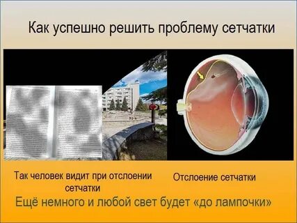 Как видит сетчатка глаза