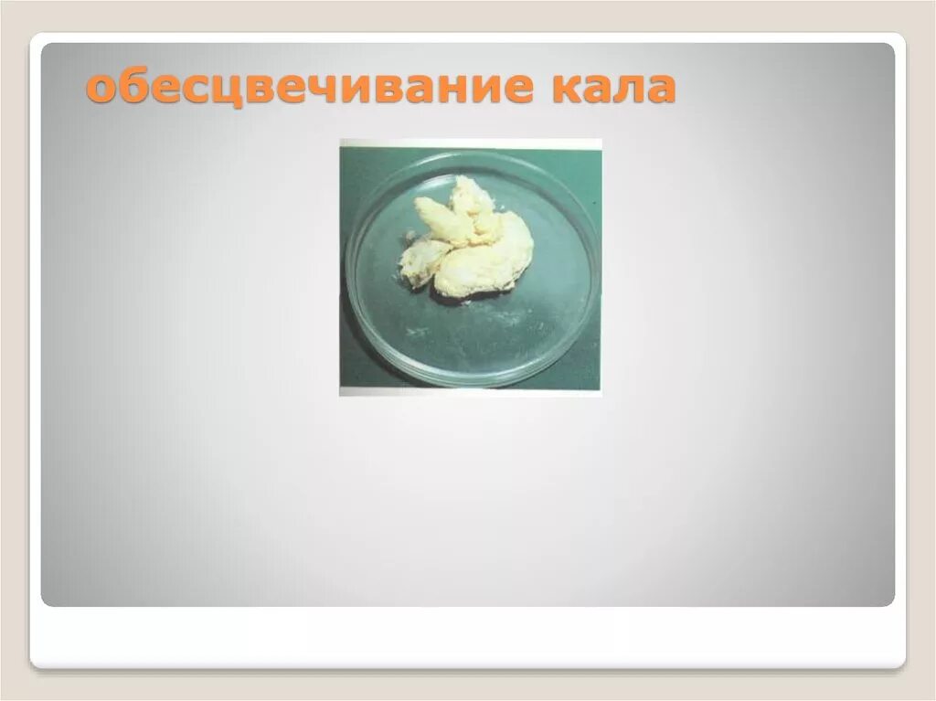 Как выглядит белый кал у человека Глисты или слизь 8 ответов форум Babyblog