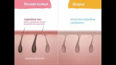 Что лучше воск или паста для депиляции