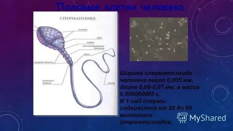 Акросома