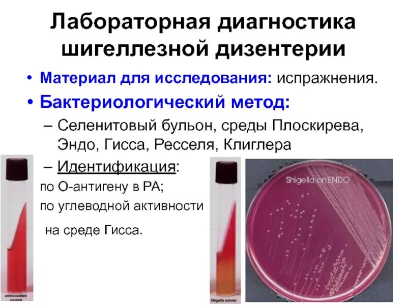 Методы лабораторной диагностики микробиология. Бактериологический метод диагностики дизентерии. материал для бактериологического исследования при шигеллезе. метод исследования при дизентерии. бактериологический метод исследования дизентерии.