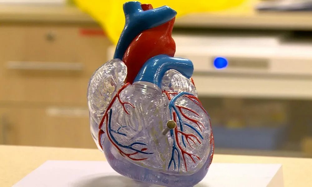 Искусственное сердце. Искусственные органы сердце. Искусственное человеческое сердце. Разработка искусственного сердца.