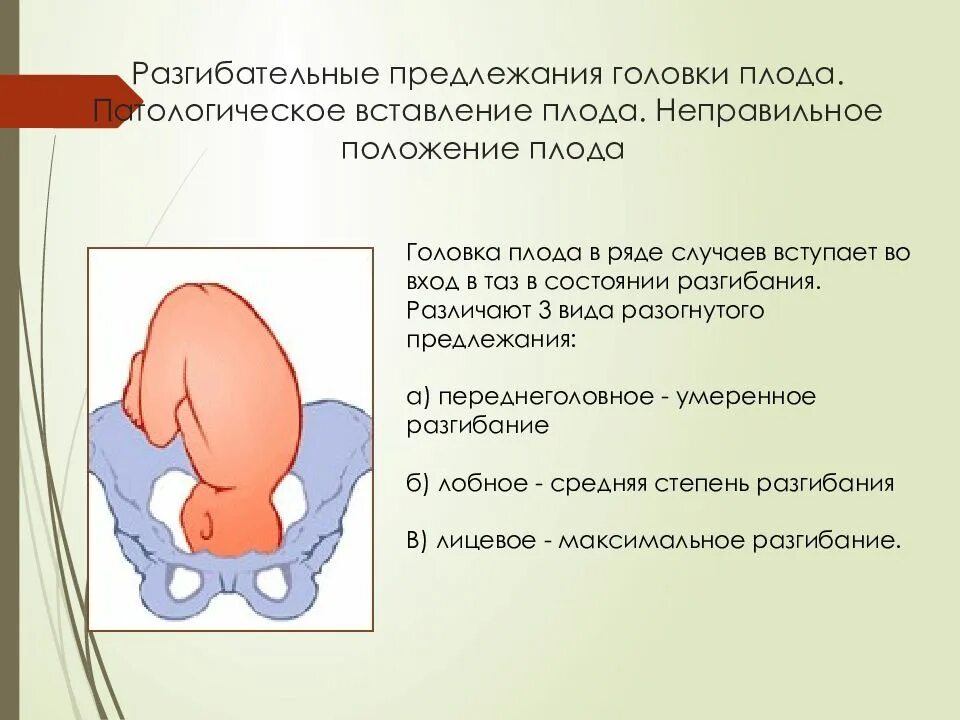 Самопроизвольное предлежание. Разгибательные предлежания плода биомеханизм. Неправильное вставление головки плода. Неправильные положения и предлежания плода. Неправильное предлежание головки плода.