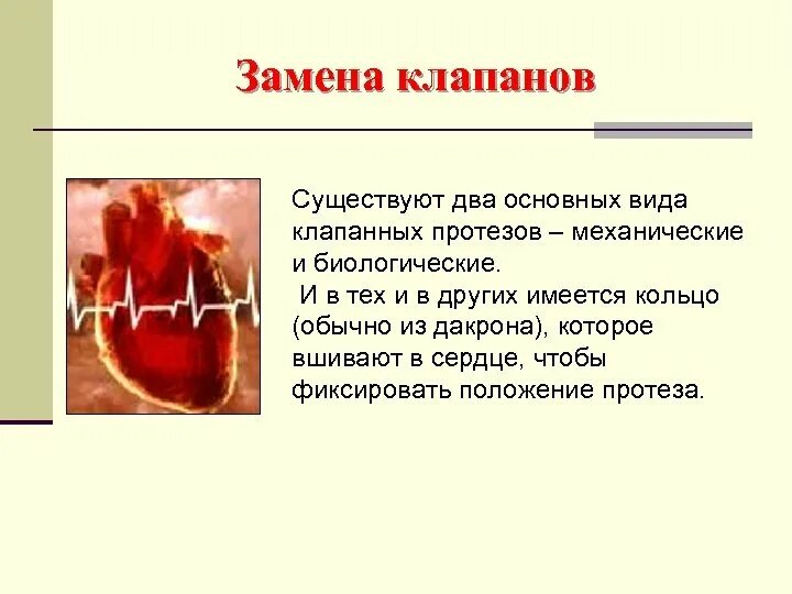 Инвалидность после замены клапана