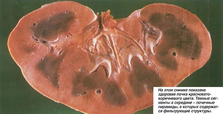 Human kidney anatomy stock illustration. Illustration of surface - 92547005