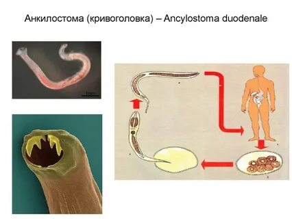 Кривоголовка