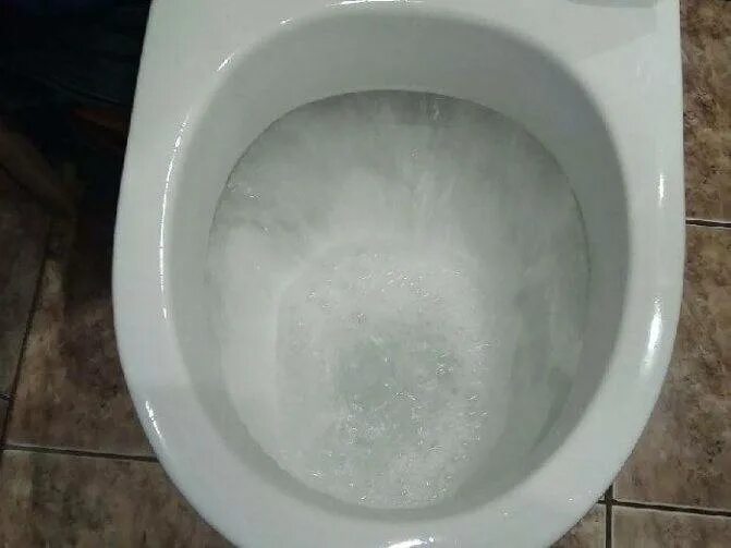 Унитаз-биде geberit aquaclean. Душевой смыв унитаза. Geberit aquaclean. Jacob delafon odeon rive gauche подвесной унитаз. Смыв унитаза.