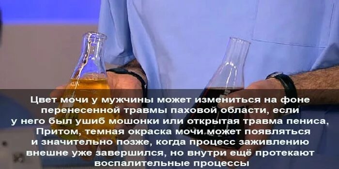 Моча у мужчин. Тёмная моча у мужчин. Цвет мочи при простатите у мужчин. Причины темной мочи у мужчин. Моча темного цвета у мужчин причины.