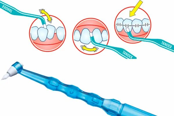 Как чистить монопучковой щеткой. Монопучковая зубная щетка техника чистки. Монопучковая зубная щетка для чего. Щетка курапрокс монопучковая щетка. Curaprox зубная щетка 708.