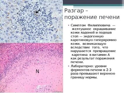 Цвет поражения