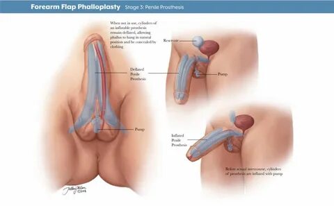 Transgender Female To Male Porn.