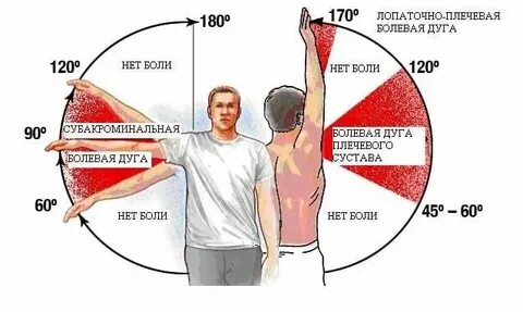 Месяц болит левая рука