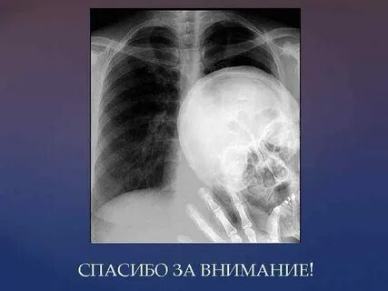 Внимания легких