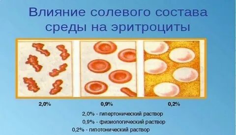 Гипертонический раствор для повязок как приготовить