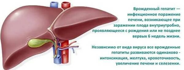 Внутриутробный гепатит. Врожденные гепатиты у детей. Гепатит новорожденных. Родила с гепатитом с