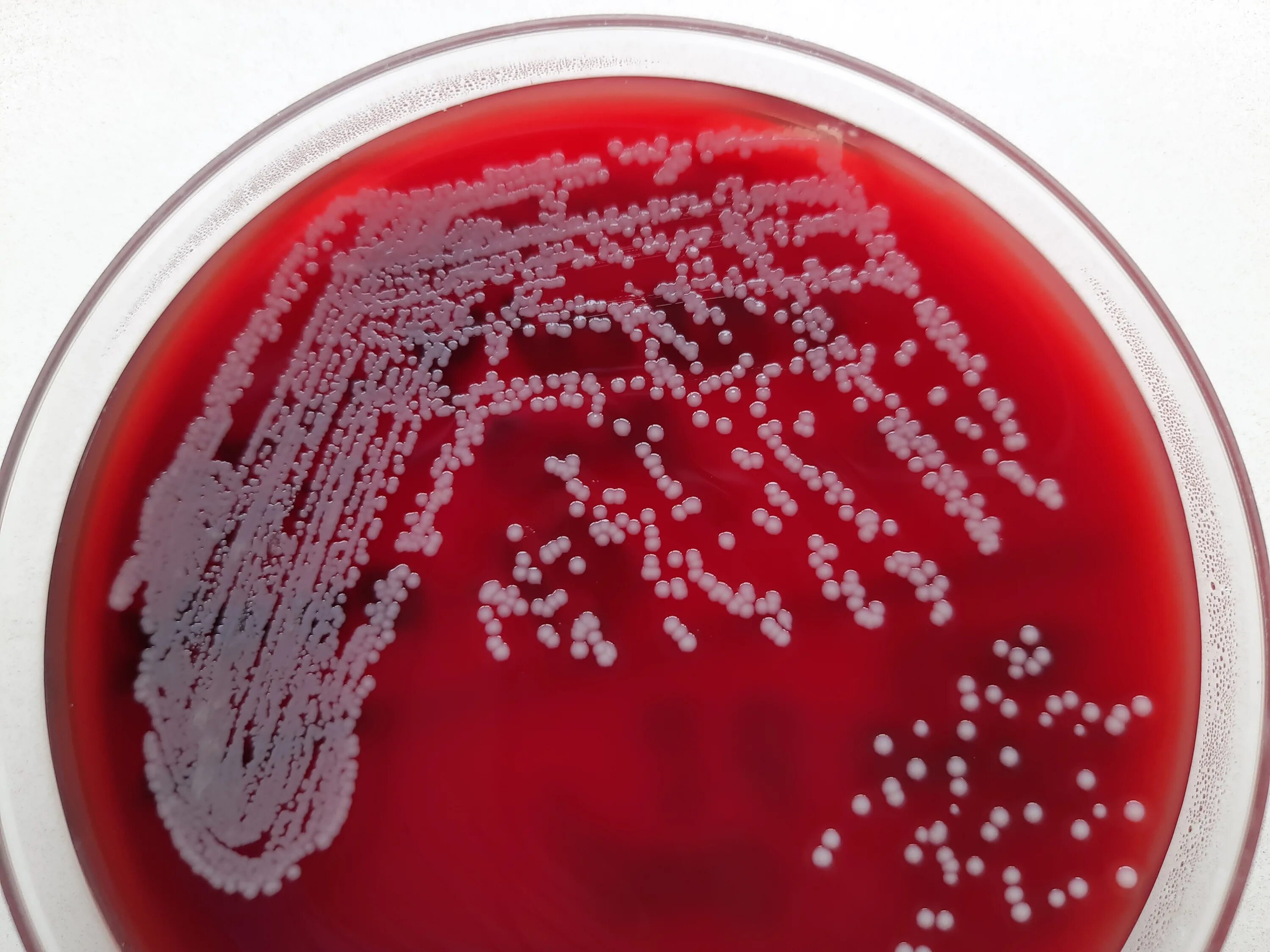 S. aureus золотистый стафилококк. Сапрофитный стафилококк. Сапрофитный стафилококк Staphylococcus saprophyticus. Staphylococcus aureus среда