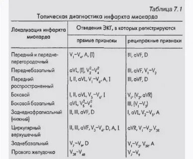 Тест инфаркт миокарда экг