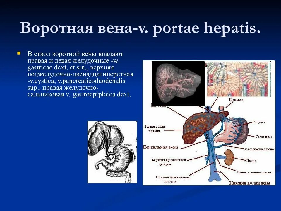 Анатомия воротной вены в печени. Ветви воротной вены в печени. Воротная Вена печени и анастомозы. Правая воротная вена