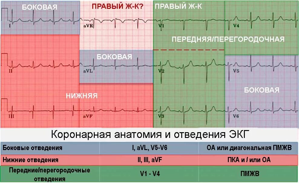 Зубец t в отведениях ii, iii, avf. Инфаркт миокарда экг реципрокные изменения. Ишемия на экг. V1 v2 экг. Экг при нижнем инфаркте миокарда левого желудочка.