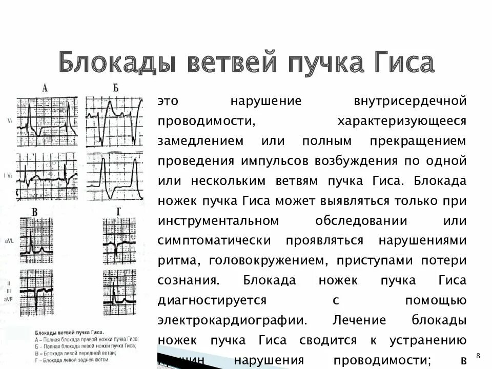 Нарушение блокады гиса. Блокада левой ветви левой ножки пучка Гиса. Блокада левой ножки пучка Гиса (нарушение проводимости) ЭКГ. Блокада передней ветви левой ножки. Неполная блокада передней ветви правой ножки Гиса.