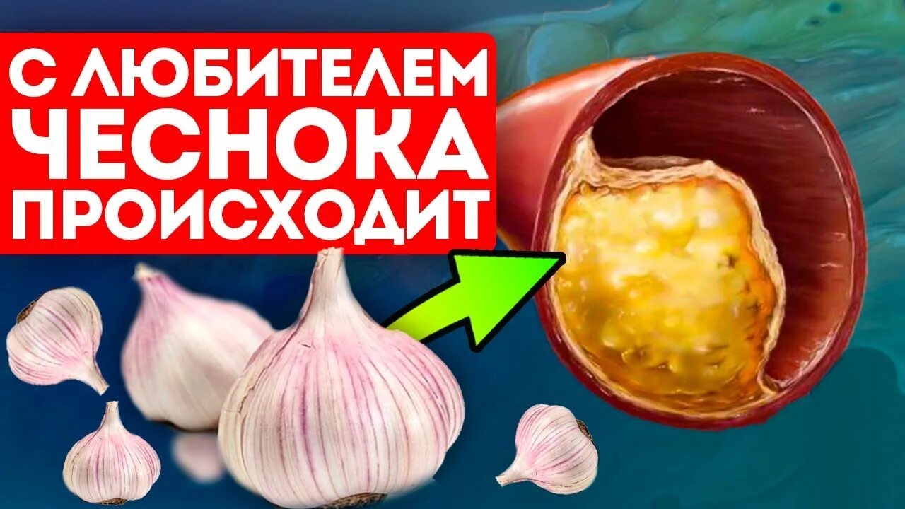 Может ли чеснок повысить давление. Чеснок и холестерин. чеснок и сердце. чеснок понижает холестерин. чеснок разжижает кровь.