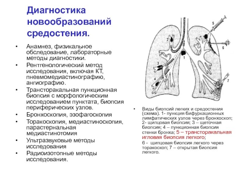 Злокачественная опухоль средостения рентген схема. Злокачественная опухоль средостения рентген. Патогенез опухолей средостения. Опухоли средостения классификация локализация. Через легкие удаляются