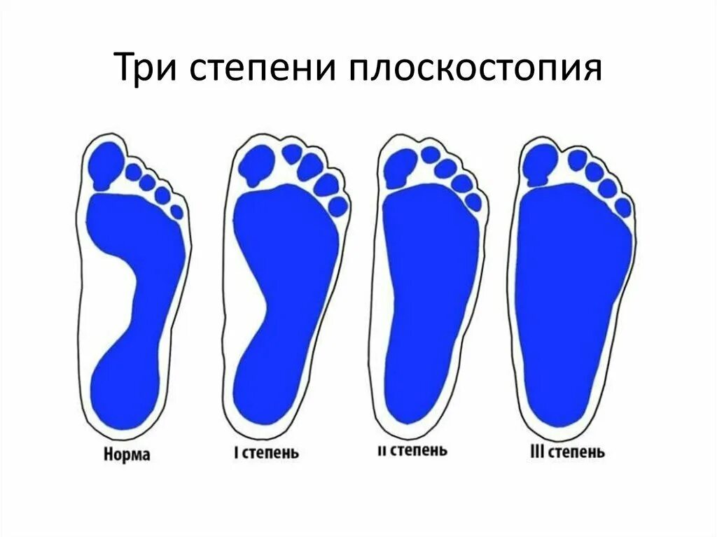 Iii стадия