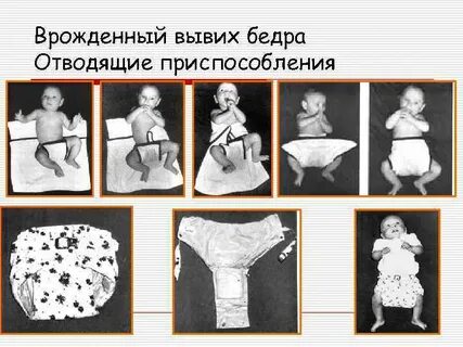 Врожденный травматологии